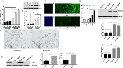 Role of TG2-Mediated SERCA2 Serotonylation on Hypoxic Pulmonary Vein Remodeling